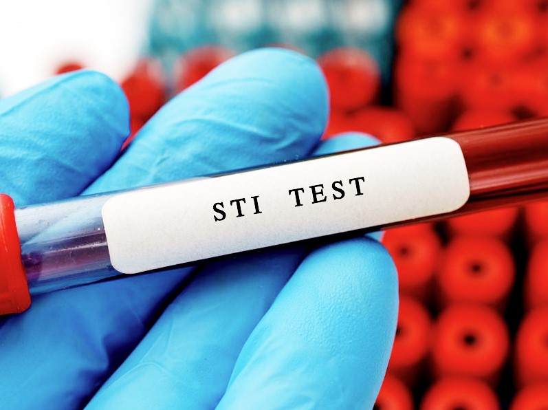 STI Testing and Treatment.jpeg